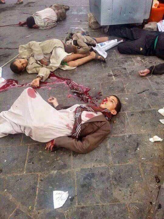 Saudi bombing on 20th April in Sanaa. WARNING GRAPHIC CONTENT: Source:Yemen Real News
